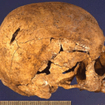 Fig. 4. The skull of Individual 10 showing the signs of the mortal blows (Pian di Civita) (Tarquinia Project).