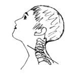 Fig. 15. The direction of the head cutting of Individual 9 (Pian di Civita) (Tarquinia Project).